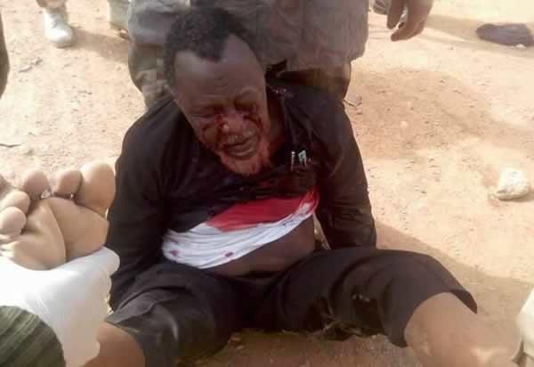 Picture-of-bleeding-sheikh-Zakzaky