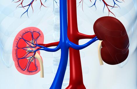 kidney disease