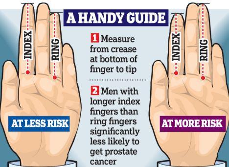 index-finger-longer-than-ring-finger-prostate-cancer
