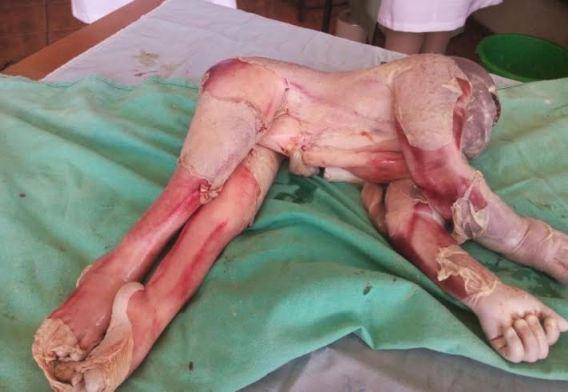Woman gives birth to a strange looking baby Baby looking like Monkey, Ape -1