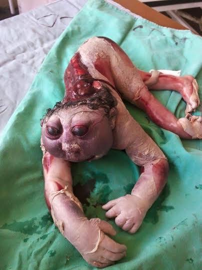 Woman gives birth to a strange looking baby Baby looking like Monkey, Ape -2